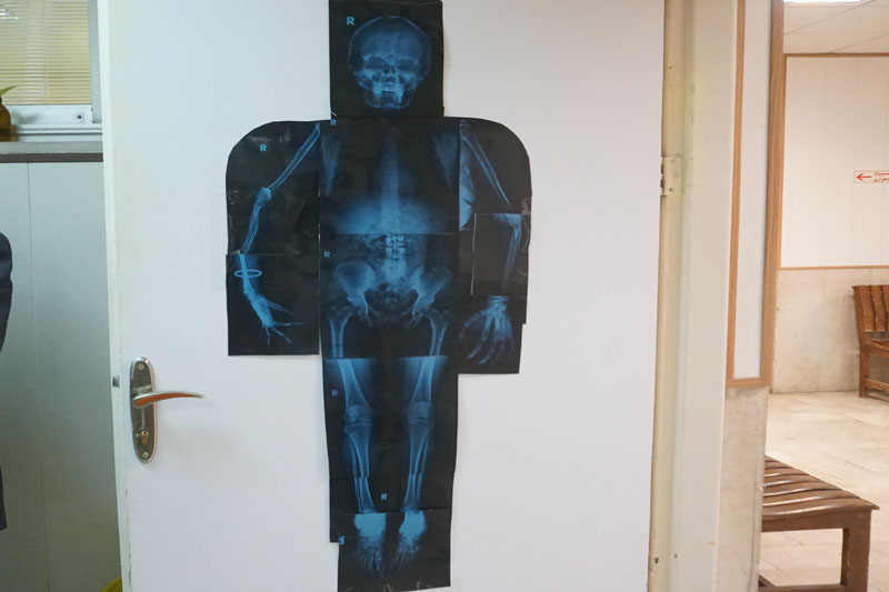 روز پرستار و رادیولوژی 49