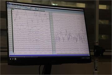 نصب و راه اندازی دستگاه پیشرفته نوار مغز(EEG) در درمانگاه صنعت نفت مشهد
