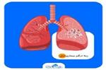 تشنه اکسیژن, در آرزوی تنفس, روایت رنج و امید به زندگی